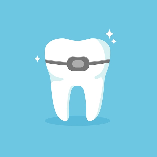 Bretelle sui denti concetto di trattamento ortodontico illustrazione vettoriale isolata su sfondo blu