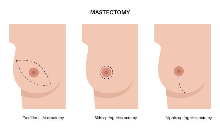 Vector the breast cancer awareness month