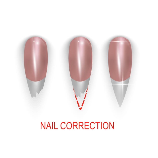 Broken or bitting nail correction, illustration set on white background. Vector eps 10 format