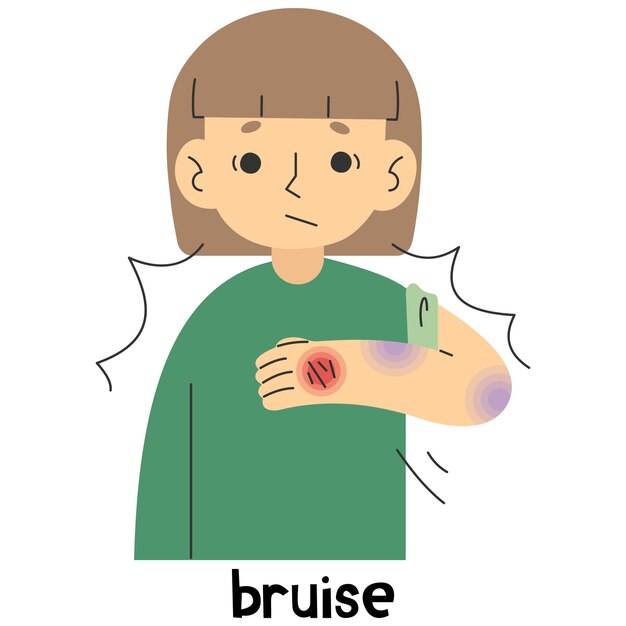 Vector bruise 5