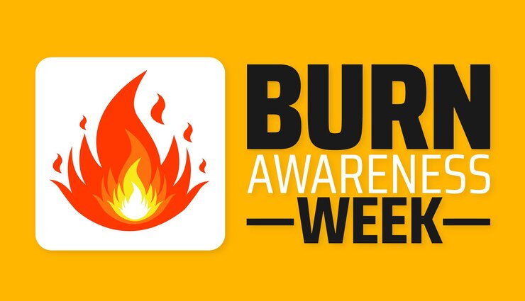 Vector burn awareness week (燃焼意識週) は毎年2月に開催される背景のバナーやポスターデザインのテンプレートです