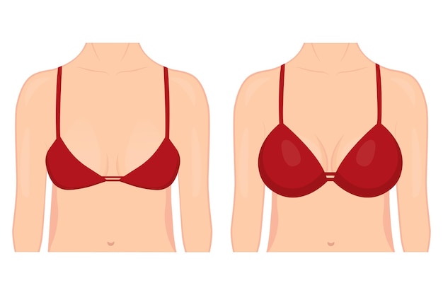 Buste van een vrouw voor en na plastische chirurgie voor borstvergroting. een vrouw in een beha met div