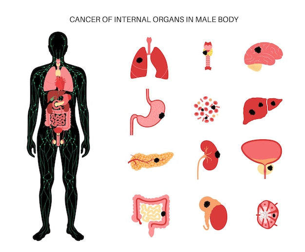 내부 장기의 암. 종양학 클리닉 로고. 인체의 종양.
