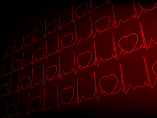 Cardiogram ECG.