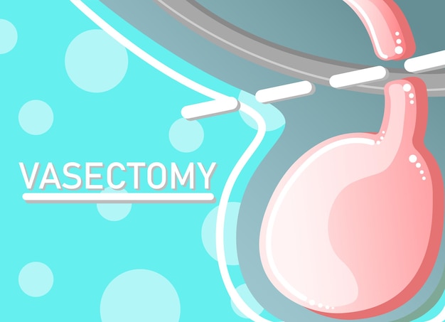 cartoon style vasectomy example vector illustration