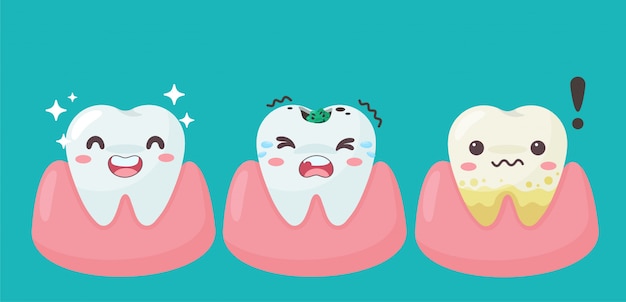 口の中の漫画の歯と歯茎は虫歯の問題に満足しています。歯に歯垢があります。