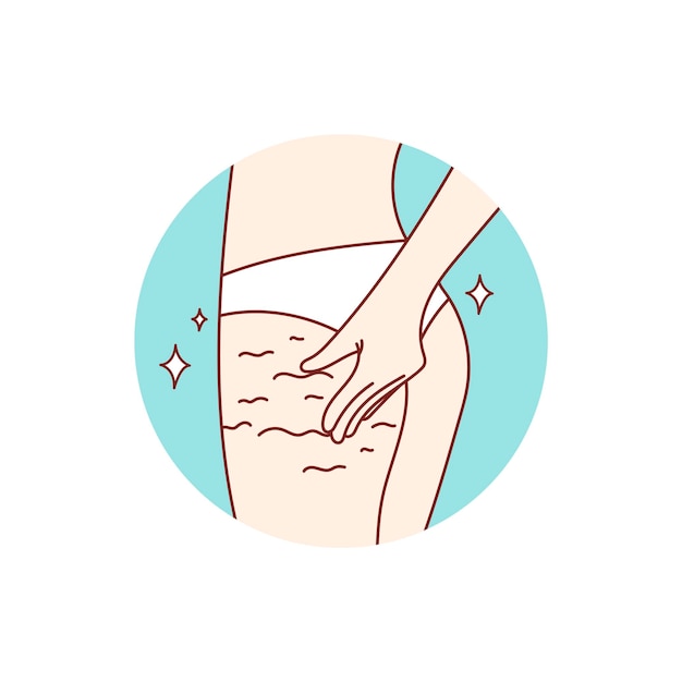 Cellulitis behandeling. Lichaamsverzorging. Spa-procedure. vector illustratie