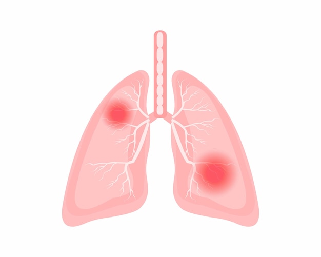 Chest discomfort Pain in the lungs human body lungs anatomy