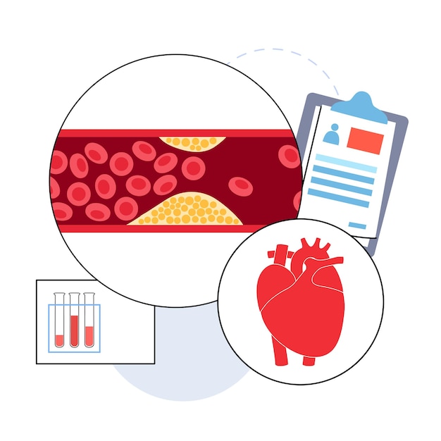 Vector cholesterol hartziekte