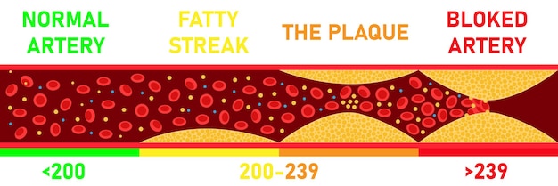 Vector cholesterol level on blocked blood vessel medical bad hdl lipoprotein high and low fat test