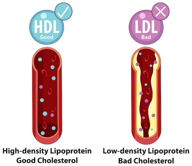 콜레스테롤 유형 HDL vs LDL