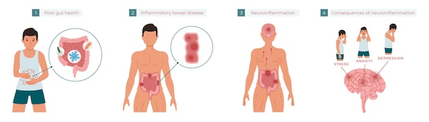Вектор Хроническое воспаление, вызывающее стрессовую тревогу и депрессию