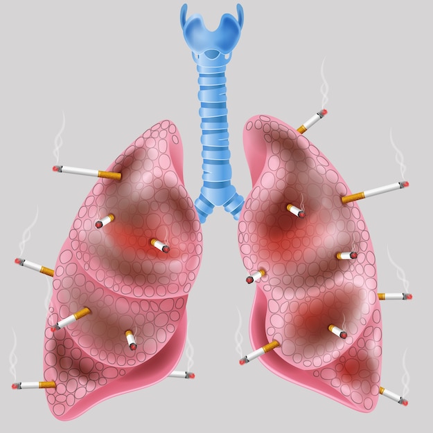 Vettore sigaretta al polmone
