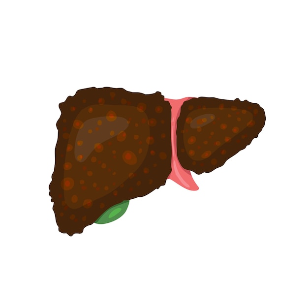 Vector cirrhosis liver cancer disease healthcare medical sickness damage doctor hospital