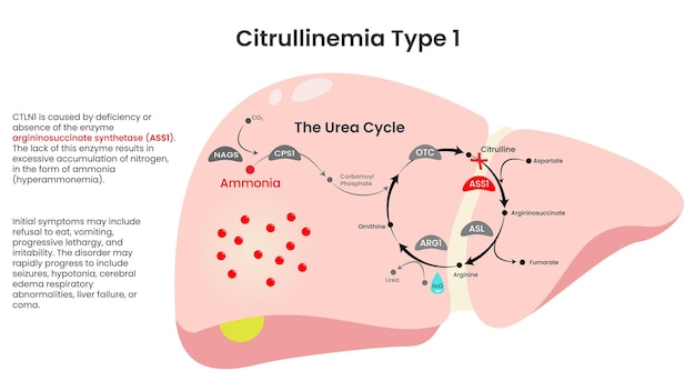 Vector citrullinemia type 1 ass1 deficiency informational vector