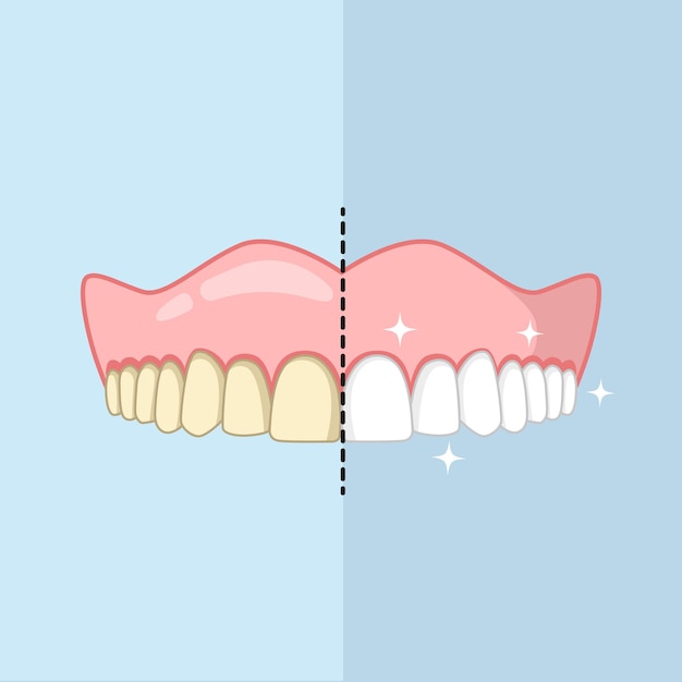 Vector clean and dirty teeth, whiten or clean teeth illustration