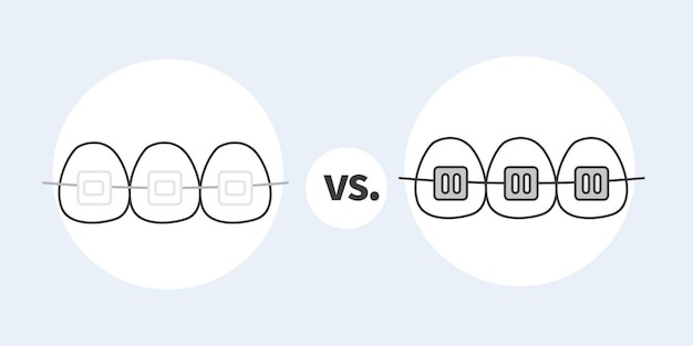 Vector clear braces icon vs metal braces icon vector illustration