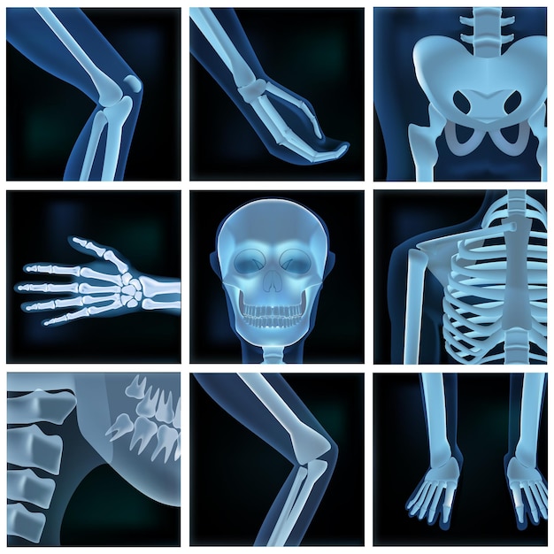 Collage van vele röntgenfoto's delen van een man
