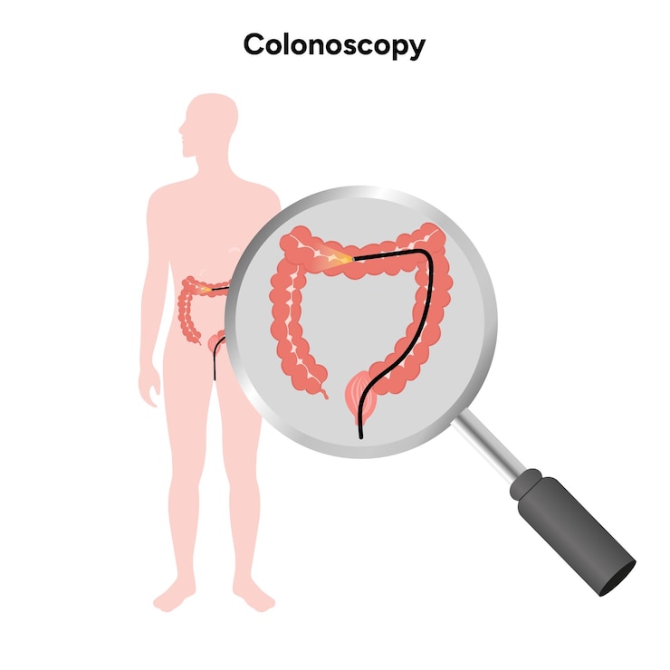 Vector colonoscopy zoom in man