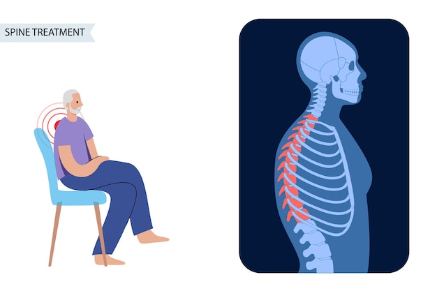 Combined scoliosis in woman body. Spinal pain center concept. XRay flat vector illustration