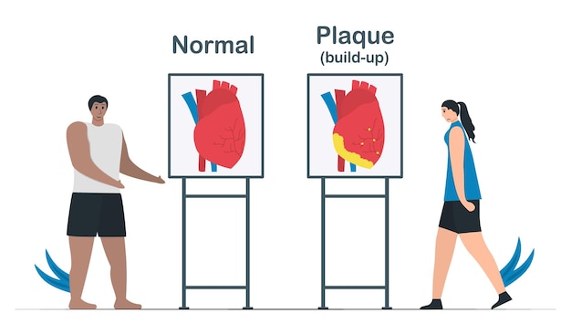 정상 심장 및 관상 동맥 질환의 비교. 플라크 축적은 동맥에 콜레스테롤 침착물을 생성할 수 있습니다. 심장 벡터 일러스트 레이 션 흰색 배경에 고립입니다.