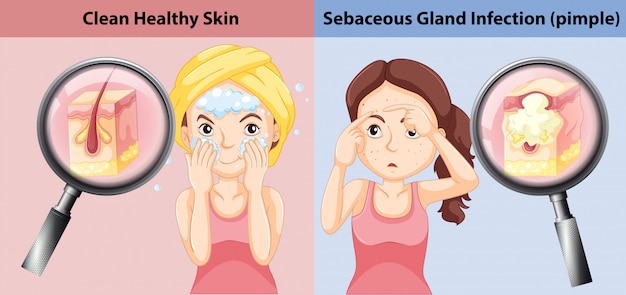 Vector a comparison of skin condition