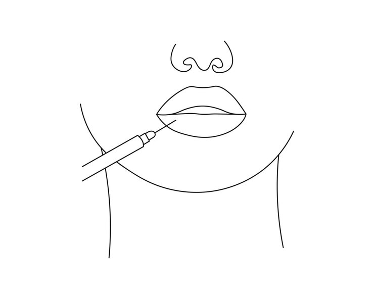 Vector continuous one line drawing of hand holding syringe lips injection beauty procedures fillers