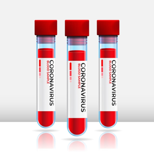 Vector coronavirus blood test in tubes