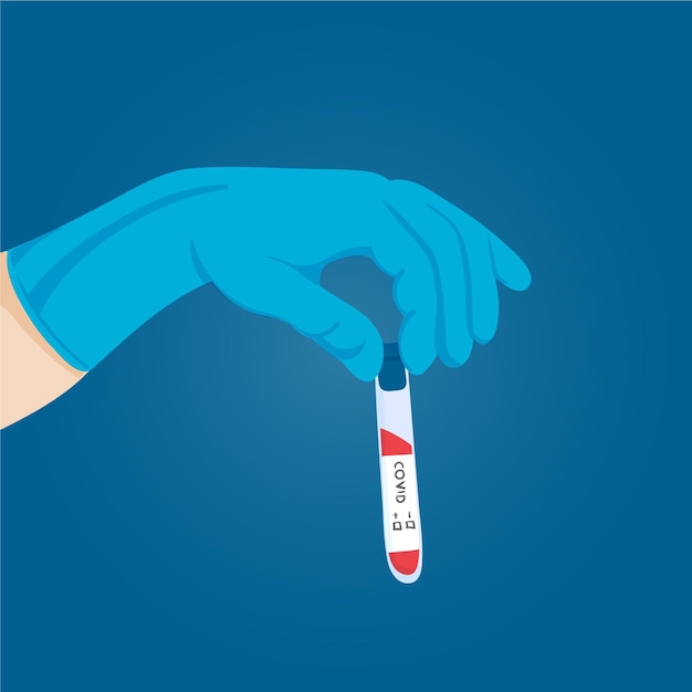 Coronavirus blood test