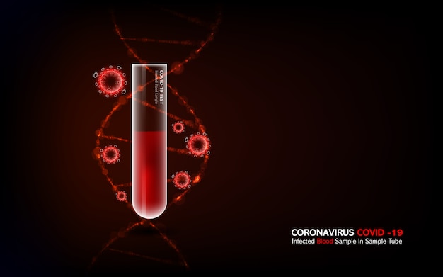 Coronavirus covid19 geïnfecteerd bloedmonster in monsterbuisje