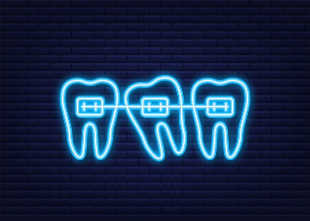 Correzione dei denti con apparecchi ortodontici. fasi di allineamento dei denti. servizi di clinica odontoiatrica. stile neon. illustrazione vettoriale.
