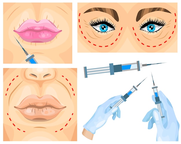 Vettore concetto di chirurgia estetica trattamento delle rughe del viso della donna