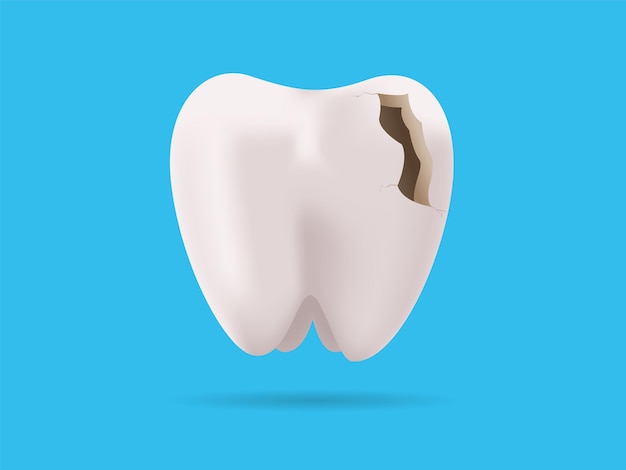 Vettore dente incrinato 3d realistico delle cure odontoiatriche con illustrazione vettoriale del dente incrinato