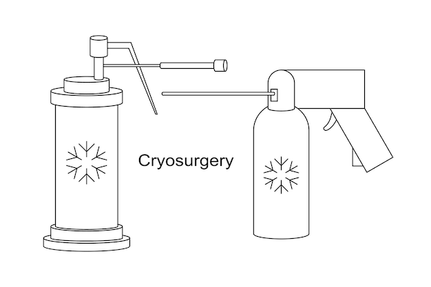 Cryo instruments for Cryosurgery vector line illustration Liquid nitrogen cooling
