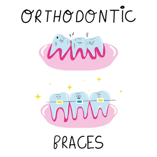 Vettore denti carini prima e dopo l'apparecchio ortodontico