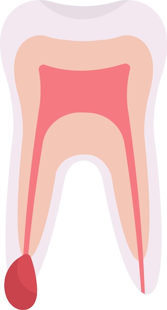 Cyst tooth problem