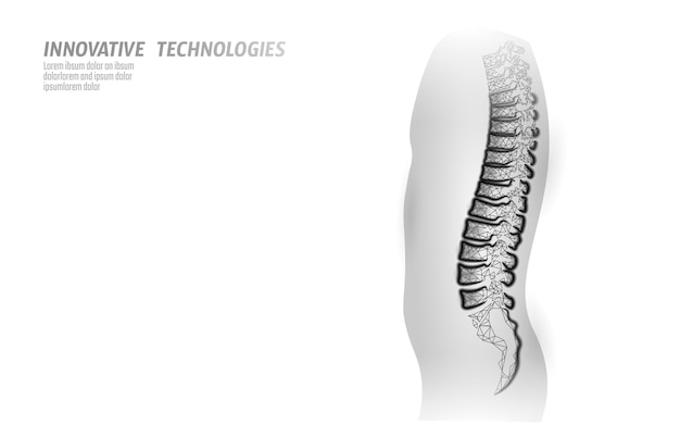 D backbone low poly physical therapy manual osteopathic massage cure bone disease wellness health al