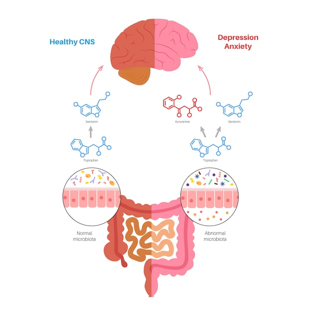 Darmhersenverbinding dysbiose en microbioom Normale en abnormale microbiota