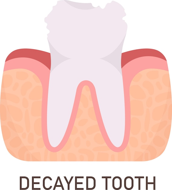 Vector decayed tooth problem