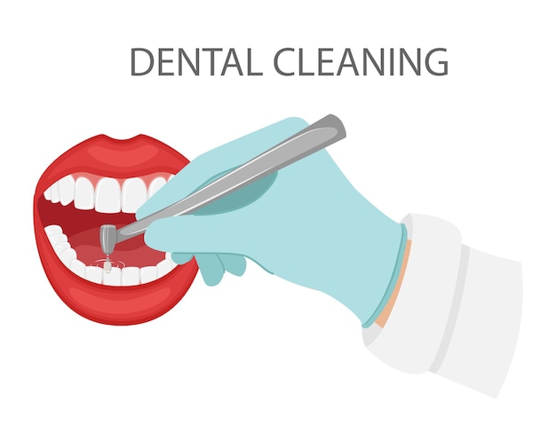 Dental cleaning of teeth. A gloved hand holds a dental polishing drill. Cosmetic,aesthetic dentistry