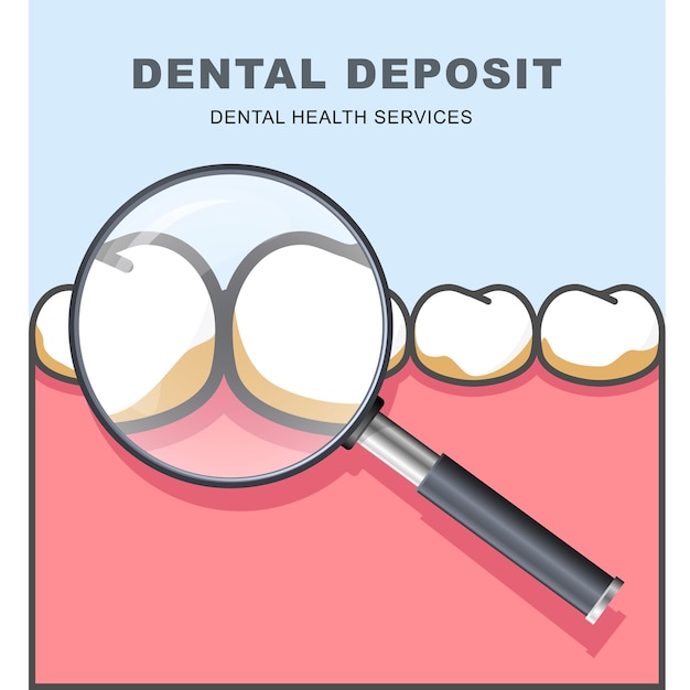 Vettore deposito dentale - fila di denti sotto la lente d'ingrandimento