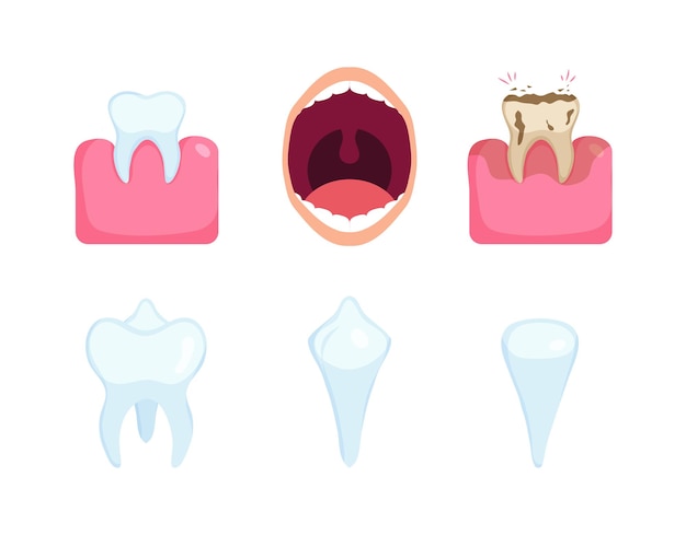 Vector dental diseases set teeth problems different injuries infographics in dentistry collection set healt
