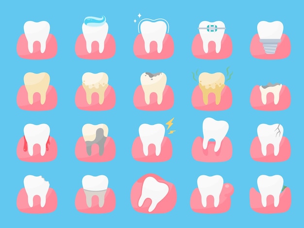 치아 건강 관리 입안의 충치와 잇몸이 붓는 문제를 해결하십시오.