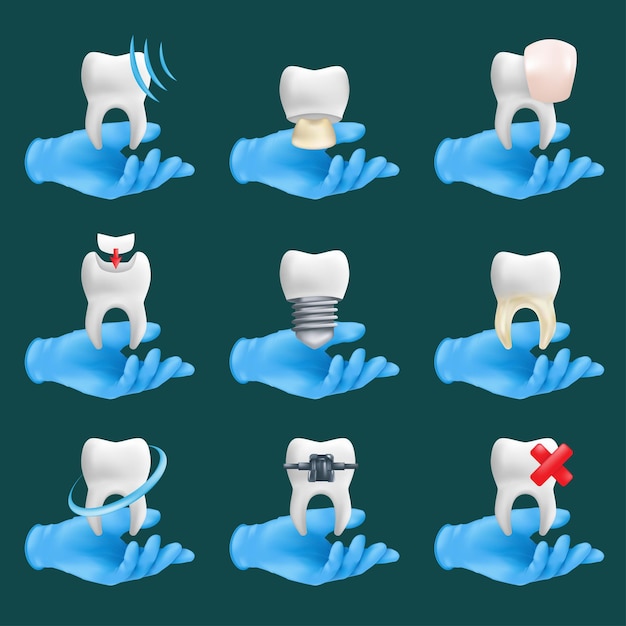 Icone dentali impostate con diversi elementi. mani del dentista realistico 3d che indossano guanti chirurgici protettivi blu che tengono i modelli di ceramica dei denti