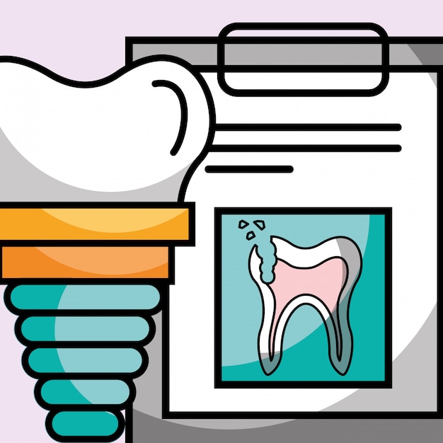 Dental implant clipboard broken tooth report