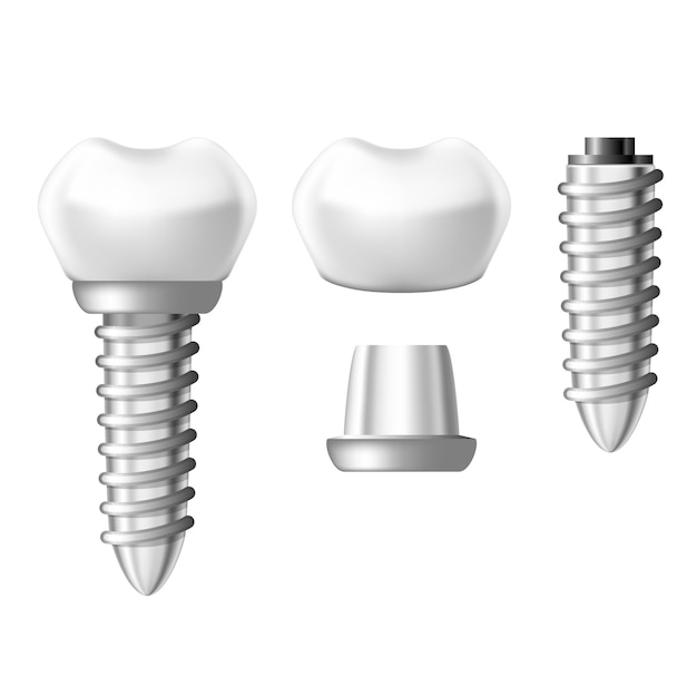 Dental implant component parts - tooth denture components
