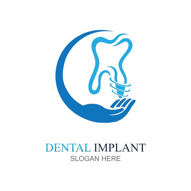 Vettore del concetto di progettazione del logo dell'impianto dentale modello del logo dental care