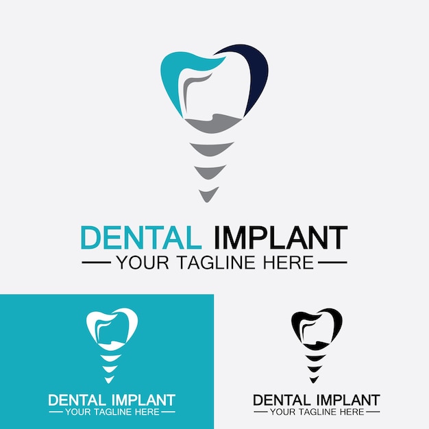 Dental implant logo vector  designs concept   Dental Clinic ampCare logo template