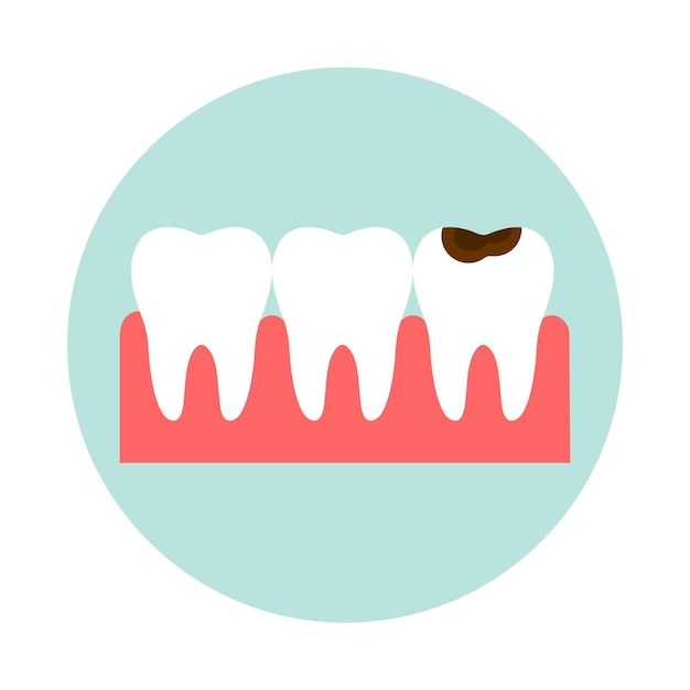 Fila dentale con denti danneggiati