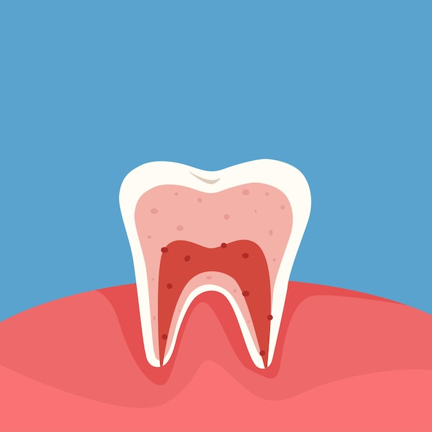 혈관이 있는 법랑질 상아질 펄프 층을 보여주는 치아 단면 다이어그램